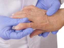 Болезни десен повышают риск ревматоидного артрита