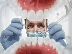 Китайцы придумали, как безопасно отбелить зубы