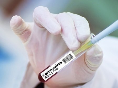 В России подтвержден 81 случай заражения британским штаммом коронавируса